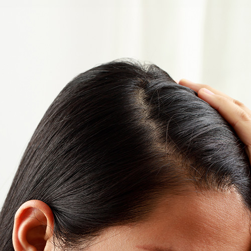 Close-up do couro cabeludo de uma mulher com cabelos pretos e lisos, enquanto ela afasta o cabelo com a mão para destacar a raiz.